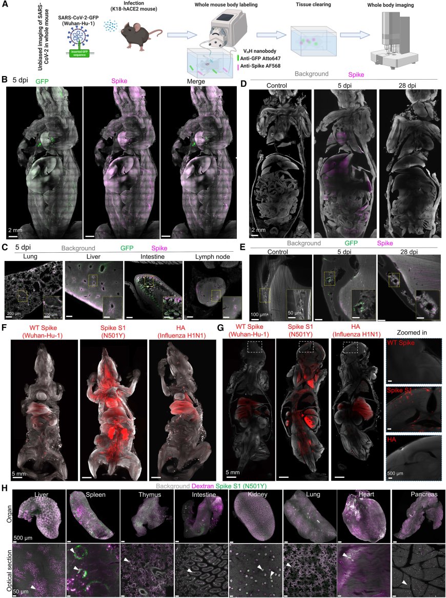 Long COVID: SARS-CoV-2 spike protein accumulation linked to long-lasting brain effects